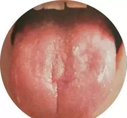 130 High-Definition Tongue Diagnosis Charts (Recommended for Collection)