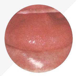 Understanding Tongue Diagnosis in TCM: Insights into Health from Tongue Appearance (Part 2)