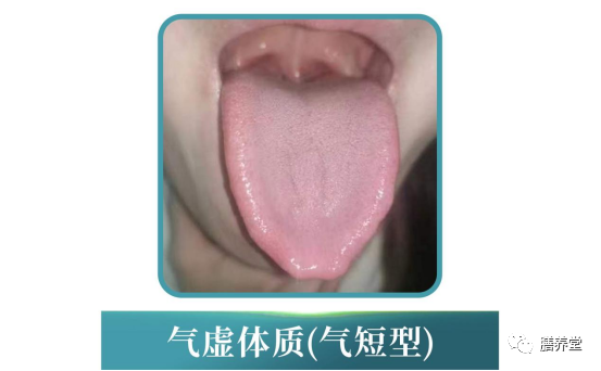 The Nine Constitutions in Traditional Chinese Medicine: Which One Are You?
