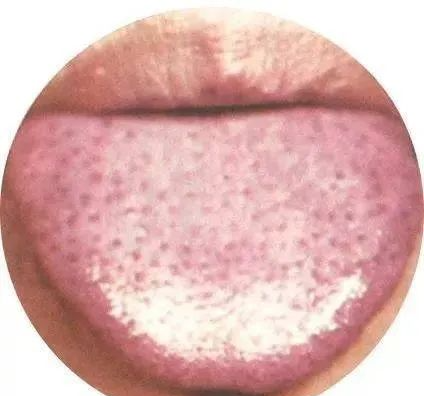 130 High-Definition Tongue Diagnosis Charts (Recommended for Collection)