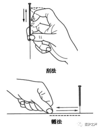 Acupuncture Techniques - Discussion on Needle Insertion Techniques (Part 2)