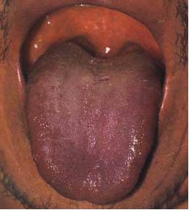 62 High-Definition Tongue Diagnosis Charts with Illustrations (Collector's Edition)