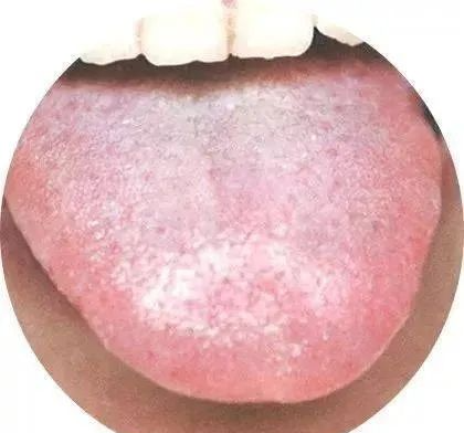 130 High-Definition Tongue Diagnosis Charts (Recommended for Collection)