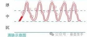 Analysis of the Slippery Pulse: Body Image, Main Diseases, and Associated Pulses