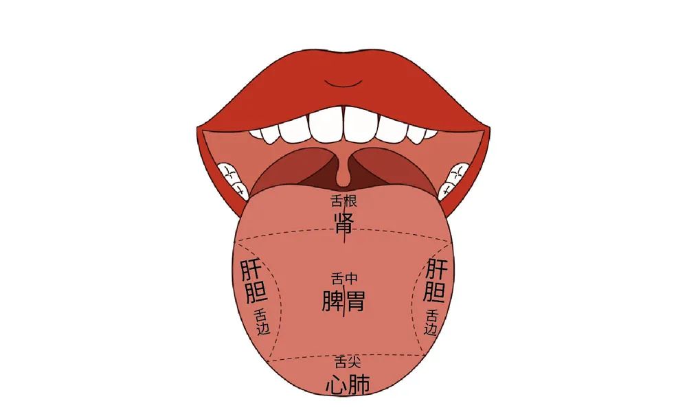 The Body Signals Illness: Understanding Tongue Diagnosis in TCM
