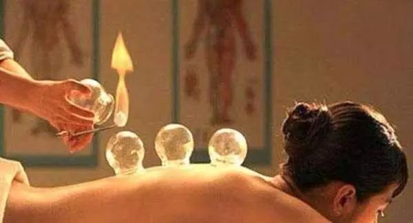 Cupping Therapy for the Back: Methods of Retention, Flash, and Sliding Cupping!