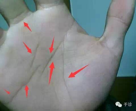 Eight Principles of Hand Diagnosis Based on Color Observation (Must-Collect)
