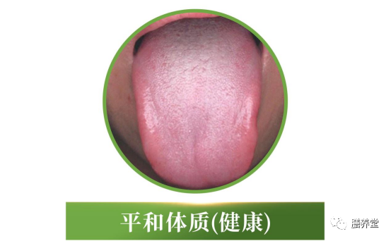 The Nine Constitutions in Traditional Chinese Medicine: Which One Are You?