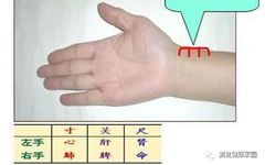 Pulse Diagnosis Methods in Traditional Chinese Medicine