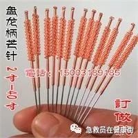 Mángzhēn Therapy: A Unique Acupuncture Technique in Traditional Chinese Medicine