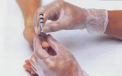 Bloodletting Therapy for 24 Difficult Diseases: A Unique TCM Approach