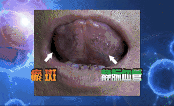 Incorrect Methods of Blood Nourishment May Prevent Pregnancy in Children!