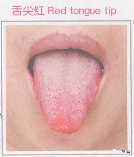 Learning Tongue Diagnosis from Scratch 5 - Tongue Color 3