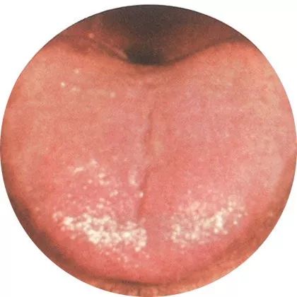 The Most Comprehensive High-Definition Real Tongue Diagnosis: Observing Tongue Patterns to Understand Internal Organs (Collection Edition)