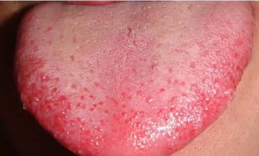 Symptoms and Dietary Remedies for Blood Deficiency, Blood Stasis, Blood Cold, and Blood Heat