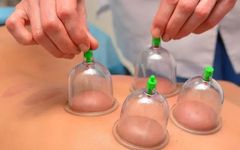 The Art of Cupping in Traditional Chinese Medicine: 5 Contraindications and Analysis of Cupping Marks
