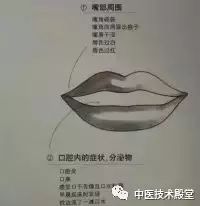 Observational Diagnosis in Traditional Chinese Medicine