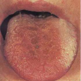62 High-Definition Tongue Diagnosis Charts with Illustrations (Collector's Edition)