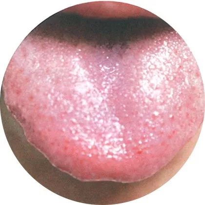 The Most Comprehensive High-Definition Real Tongue Diagnosis: Observing Tongue Patterns to Understand Internal Organs (Collection Edition)