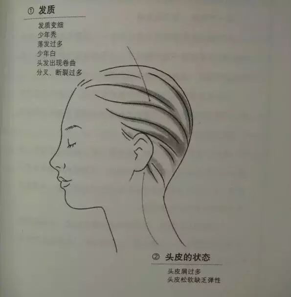 Essential Guide to TCM Observation Diagnosis: Easy to Understand (Recommended for Collection)