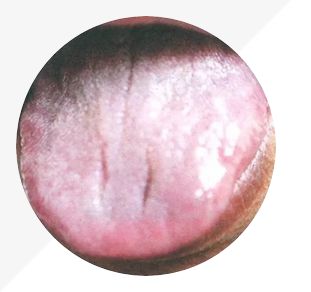 Analysis of High-Definition Tongue Diagnosis Charts: Understanding Health Through Your Tongue (Part 1)