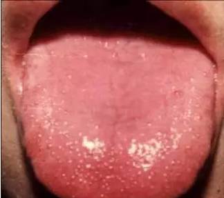 Symptoms and Dietary Remedies for Blood Deficiency, Blood Stasis, Blood Cold, and Blood Heat