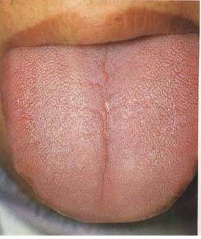 62 High-Definition Tongue Diagnosis Charts with Illustrations (Collector's Edition)