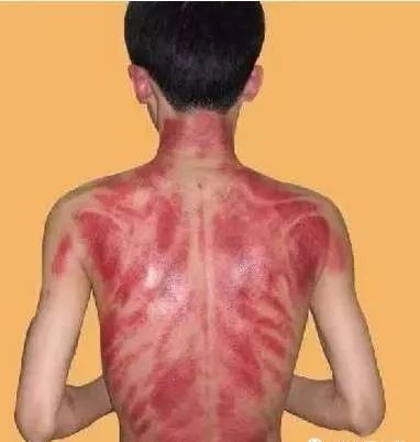 The Most Comprehensive Guide to Gua Sha Knowledge