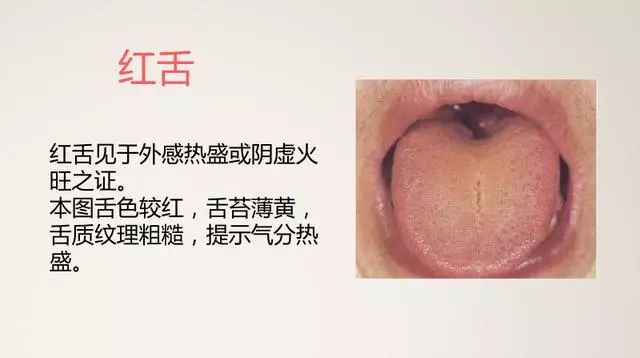 The Most Comprehensive TCM Tongue Diagnosis Atlas: Observe the Tongue, Understand the Whole Body!