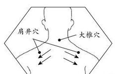 Gua Sha for Various Ailments: Insights from a Tui Na Expert