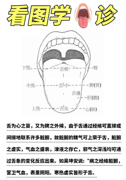 Analyzing Tongue Diagnosis: A Simple Approach to Understanding TCM