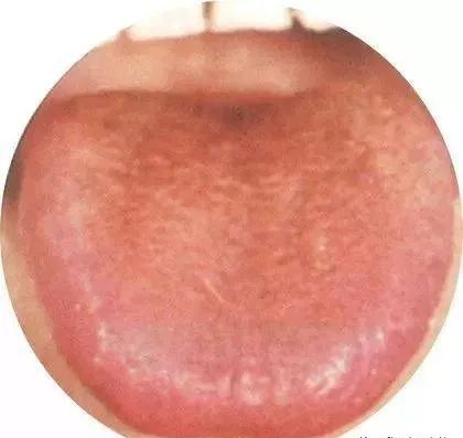 130 High-Definition Tongue Diagnosis Charts (Recommended for Collection)
