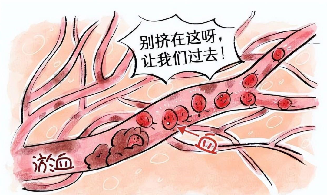 Stagnation of Yang Qi and Excess Phlegm-Dampness: The Culprit Behind Anxiety and Irritability! One Herbal Remedy to Invigorate Blood, Remove Stasis, and Alleviate Distress, Palpitations, Insomnia, and Irritability!