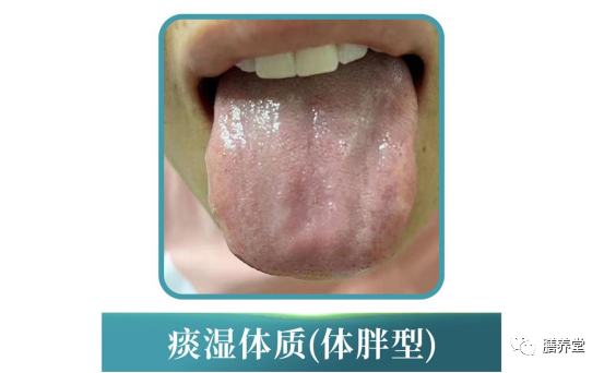The Nine Constitutions in Traditional Chinese Medicine: Which One Are You?