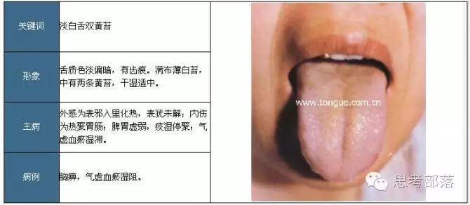 Comprehensive Guide to Tongue Diagnosis (8): 72 Types of Tongue Diagnosis Charts