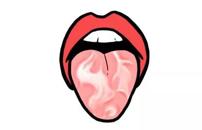 The TCM Tongue Diagnosis Atlas is Here! Observe the Tongue to Understand the Whole Body!