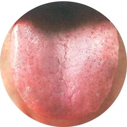 The Most Comprehensive High-Definition Real Tongue Diagnosis: Observing Tongue Patterns to Understand Internal Organs (Collection Edition)