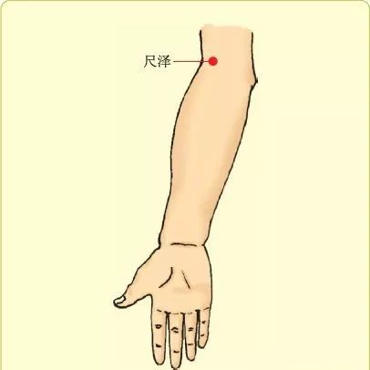 Cupping Therapy for Effective Treatment of Pharyngitis