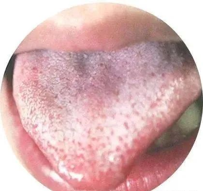 130 High-Definition Tongue Diagnosis Charts (Recommended for Collection)