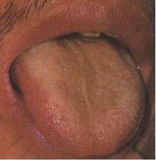 62 High-Definition Tongue Diagnosis Charts with Illustrations (Collector's Edition)