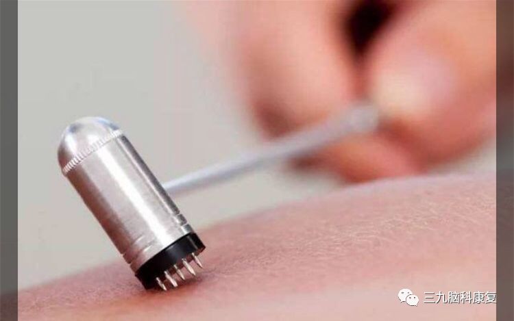 The Wonders of Bloodletting Therapy in Traditional Chinese Medicine