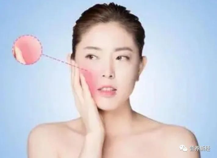 Traditional Chinese Medicine: Blood Stasis Causes Spots, Improve Blood Stasis Constitution by Regularly Consuming These 7 Ingredients