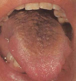 62 High-Definition Tongue Diagnosis Charts with Illustrations (Collector's Edition)