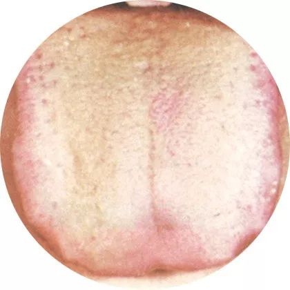 Comprehensive Guide to Tongue Diagnosis: A Must-Collect!