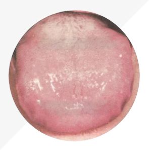 Analysis of High-Definition Tongue Diagnosis Charts: Understanding Health Through Your Tongue (Part 1)