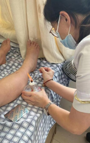 Fire Needle Therapy in Traditional Chinese Medicine