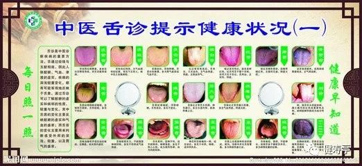 Understanding Tongue Diagnosis in Traditional Chinese Medicine (with Tongue Diagnosis Illustrations)