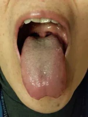 Inheritance of Traditional Chinese Medicine at Zhigu Tang | Basic Theory of TCM Lesson 34 (Tongue Diagnosis: Tongue Color)