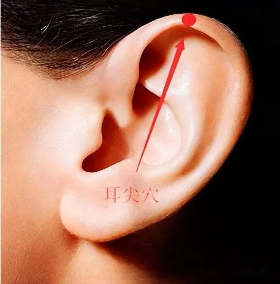 Understanding the Unique TCM Therapy: Bloodletting at the Ear Apex