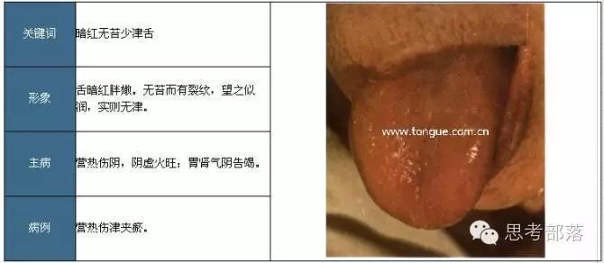 Comprehensive Guide to Tongue Diagnosis (8): 72 Types of Tongue Diagnosis Charts